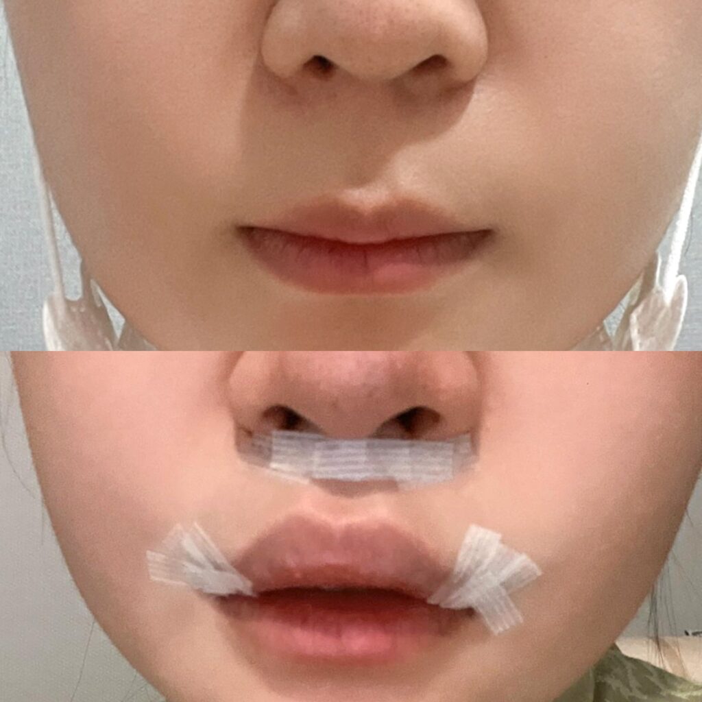 Appearance Transformation with Bullhorn in Korea