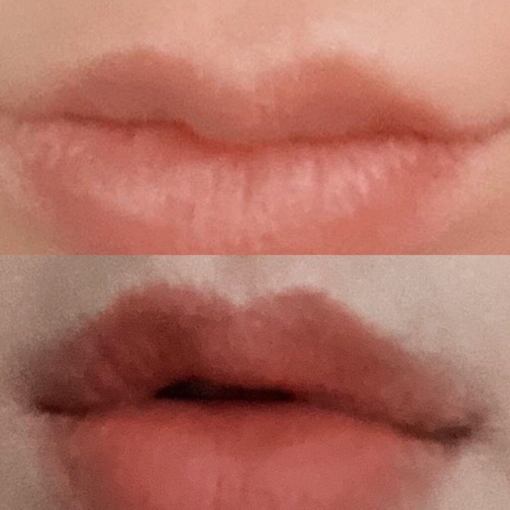 Contour Changes of Lips with Bullhorn in Korea