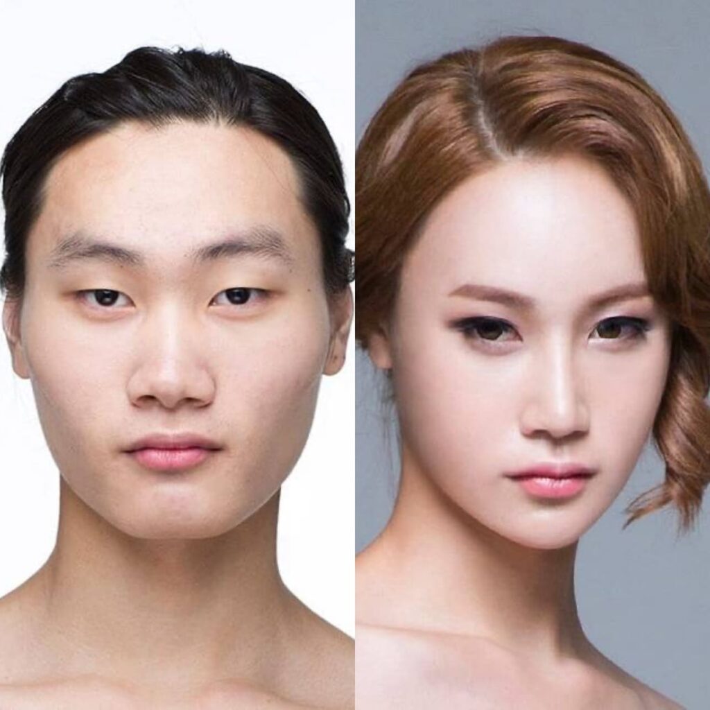 Fine-tuning the Chin_ Correction Methods in Korea