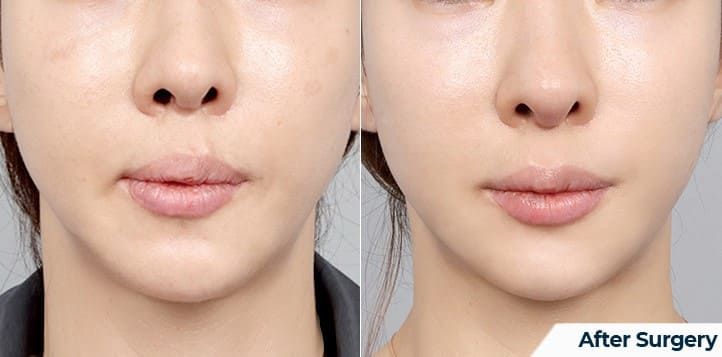 Korean Secrets for Youthful Skin and Face Lifting